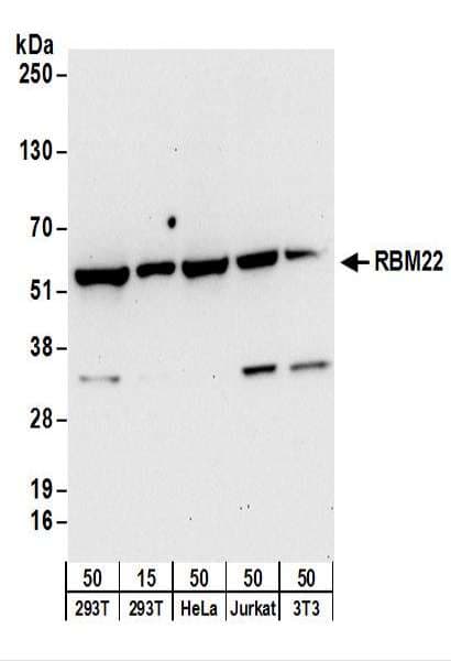 RBM22 Antibody (aa370-420)