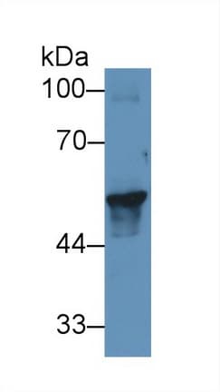 KRT17 / CK17 / Cytokeratin 17 Antibody (aa252-393)