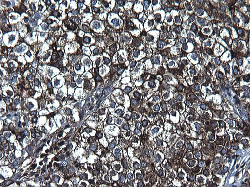 FGG / Fibrinogen Gamma Antibody (clone OTI1D11)