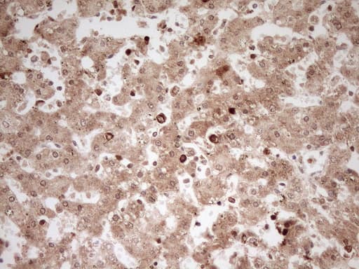 Monoclonal Mouse anti-Human MYL4 Antibody (clone OTI1H6, Carrier-free, aa2-197, IHC, WB)