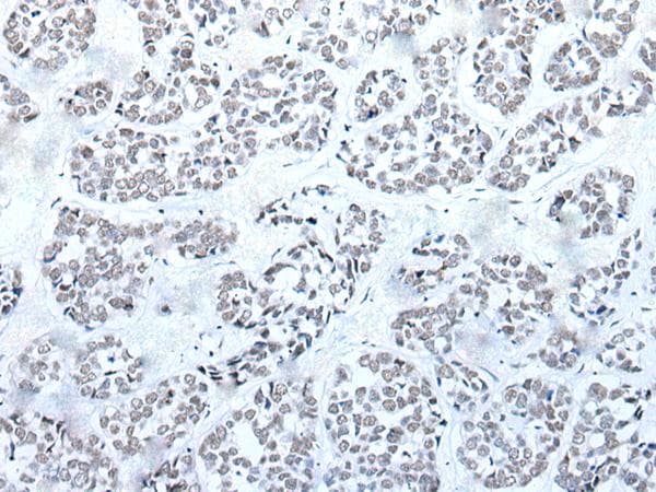 BRD3 Antibody