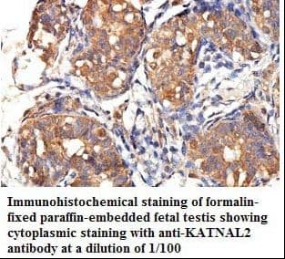 KATNAL2 Antibody (aa263-424)