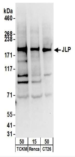 IHC-plus™ SPAG9 Antibody (aa775-825)