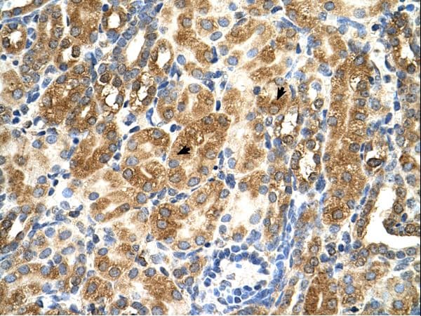 MAS1 / MAS Antibody (aa144-193)