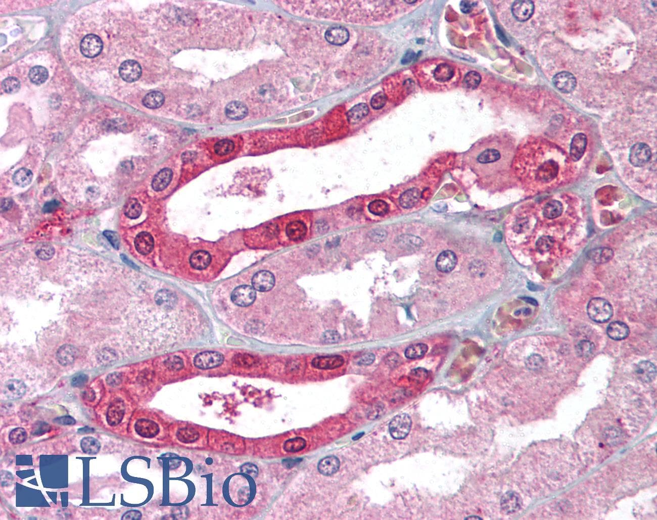 IHC-plus™ CA2 / Carbonic Anhydrase II Antibody