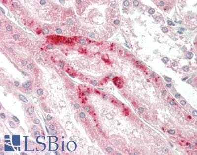 Polyclonal Rabbit anti-Human STEAP1 / STEAP Antibody (FITC, IHC, WB)