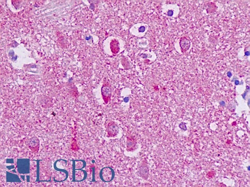 IHC-plus™ Polyclonal Rabbit anti-Human ADGRG1 / GPR56 Antibody (Cytoplasmic Domain, IHC)