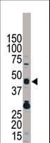 TRB3 / TRIB3 Antibody (aa15-45)