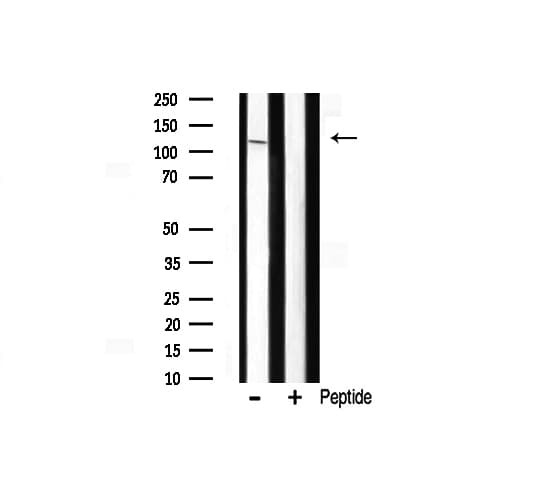MAP3K13 / LZK Antibody