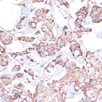 Polyclonal Rabbit anti-Human UBE2O Antibody (IHC)