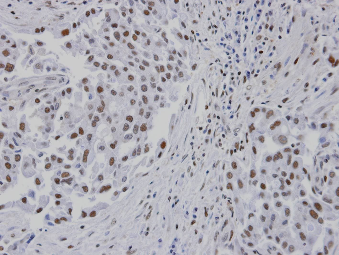 RPA3 Antibody (aa1-121)