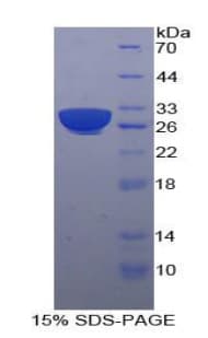 Human BLNK Protein (Recombinant His-T7)