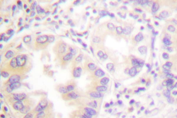 VASP Antibody (His150)