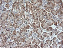 MAPK9 / JNK2 Antibody (clone OTI1A1)