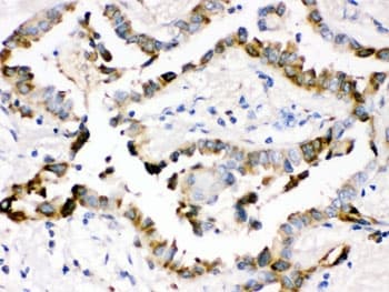SFTPD / Surfactant Protein D Antibody