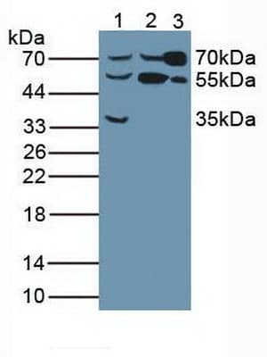 BCHE / Cholinesterase Antibody (aa29-150)