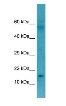 Polyclonal Rabbit anti-Human CTAG1B / NY-ESO-1 Antibody (aa60-109, WB)