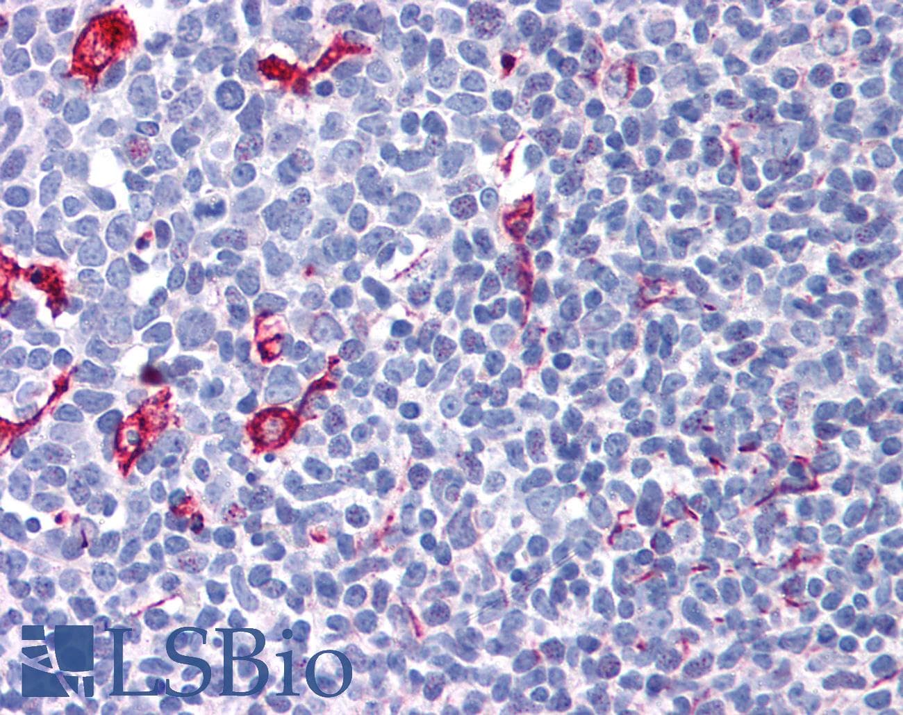 IHC-plus™ NET1 / ARHGEF8 Antibody (aa611-624)
