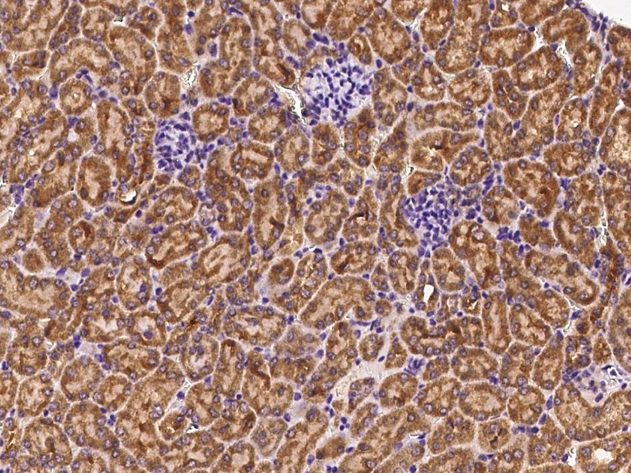 Polyclonal Rabbit anti-Human EXOC5 Antibody (Preservative Free, IHC)