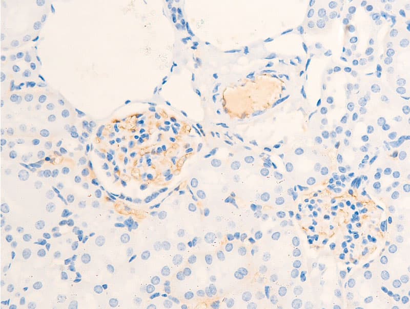 ERBB2 / HER2 Antibody (phospho-Tyr877)