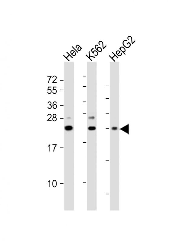 Polyclonal Rabbit anti-Human SRY Antibody (aa52-82, WB)