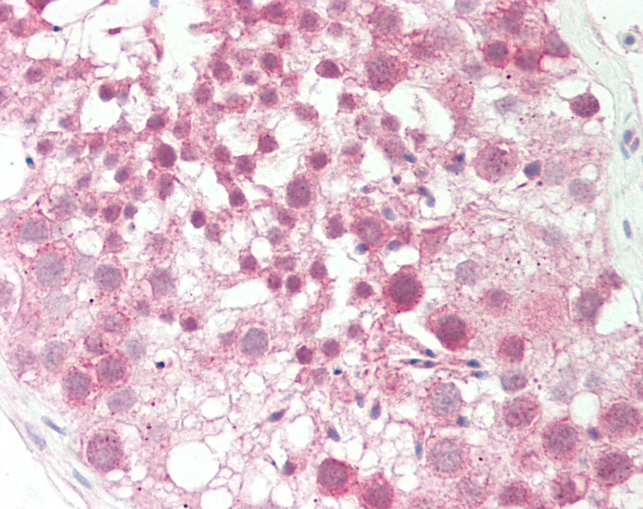 KTN1 / Kinectin Antibody (aa972-1021)