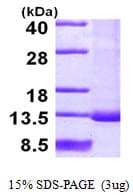 Human SNRPF Protein (Recombinant His)