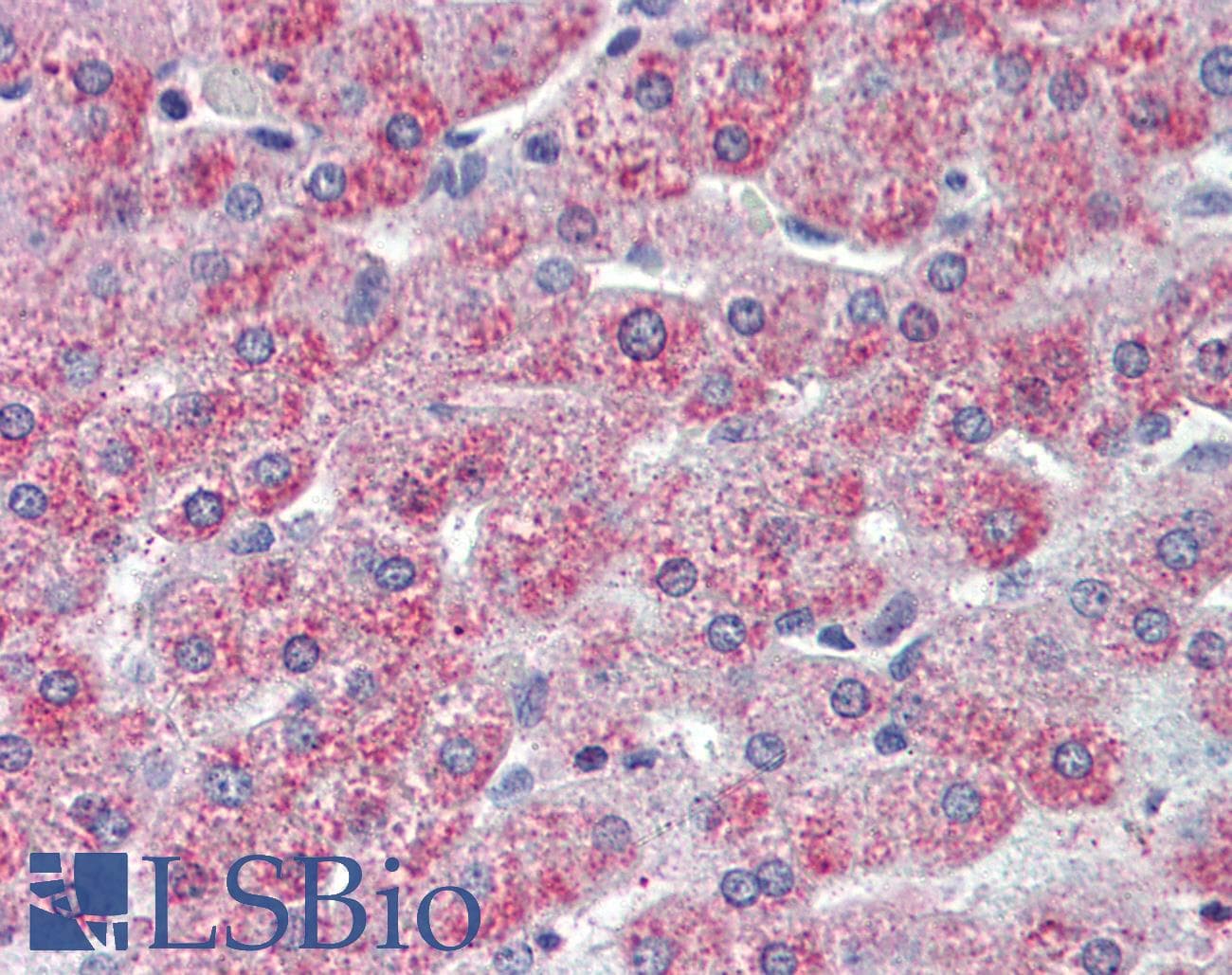 IHC-plus™ TAOK1 / TAO1 Antibody (Internal)