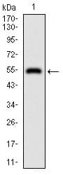 Monoclonal Mouse anti-Human DIS3L2 Antibody (clone 6C7B2, aa27-250, IHC, WB)