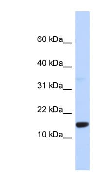 TPD52L3 Antibody (aa71-120)