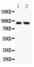 SLC9A1 / NHE1 Antibody (aa543-815)