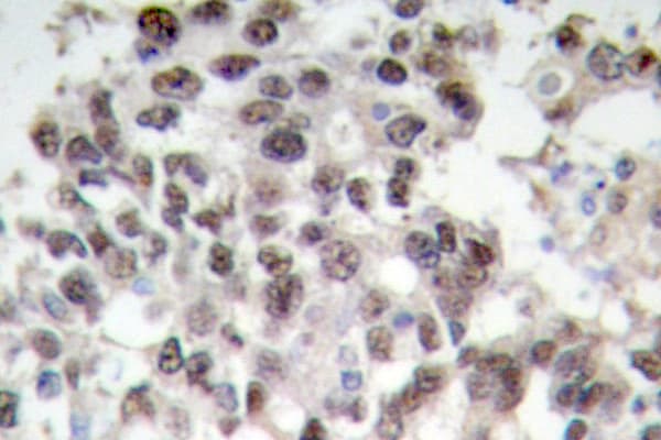 Polyclonal Rabbit anti-Human PDCD4 Antibody (Lys453, IHC, IF, WB)