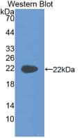KRT4 / CK4 / Cytokeratin 4 Antibody (aa317-454, Cy3)
