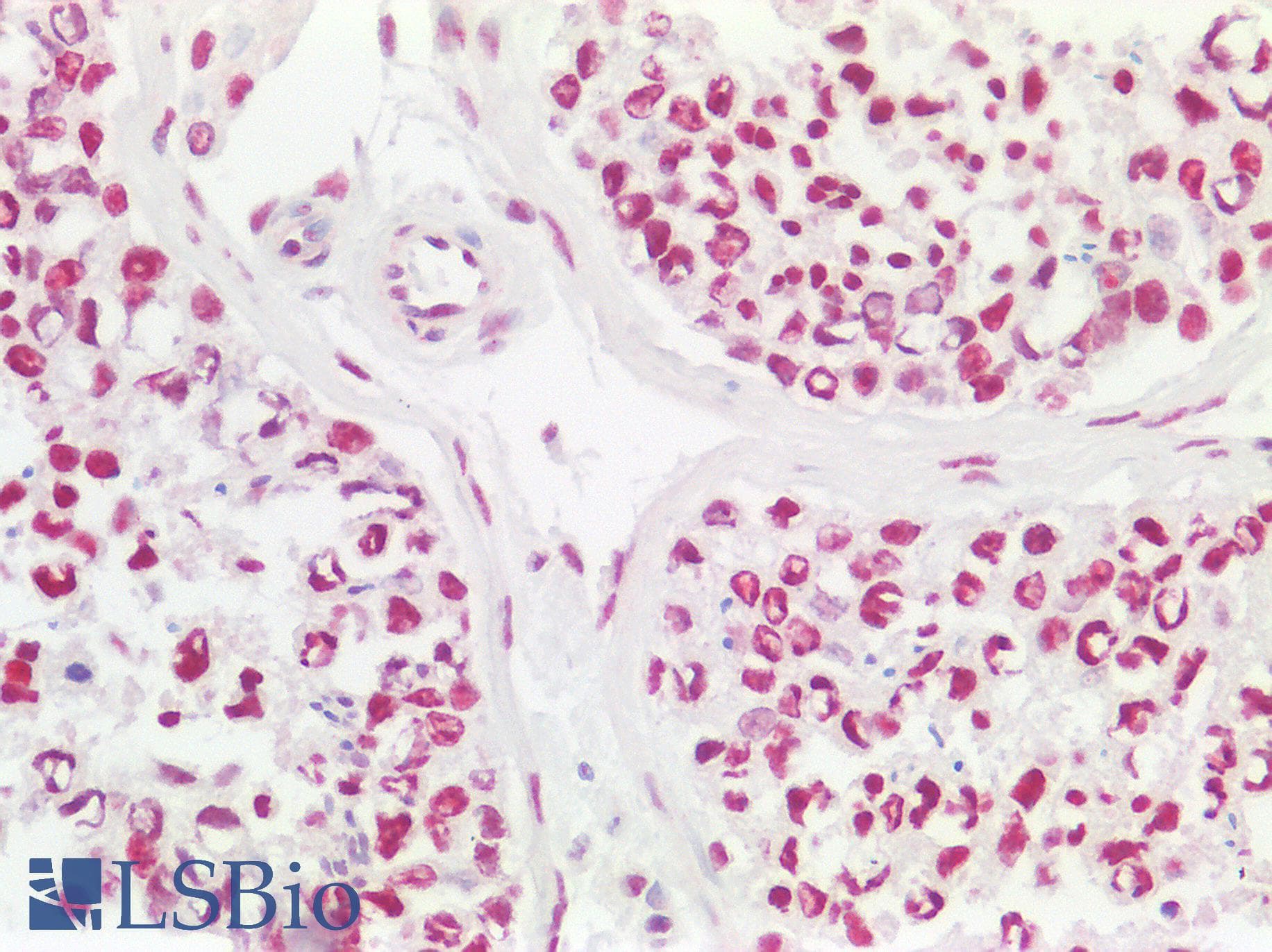 CCDC86 Antibody (aa101-150)