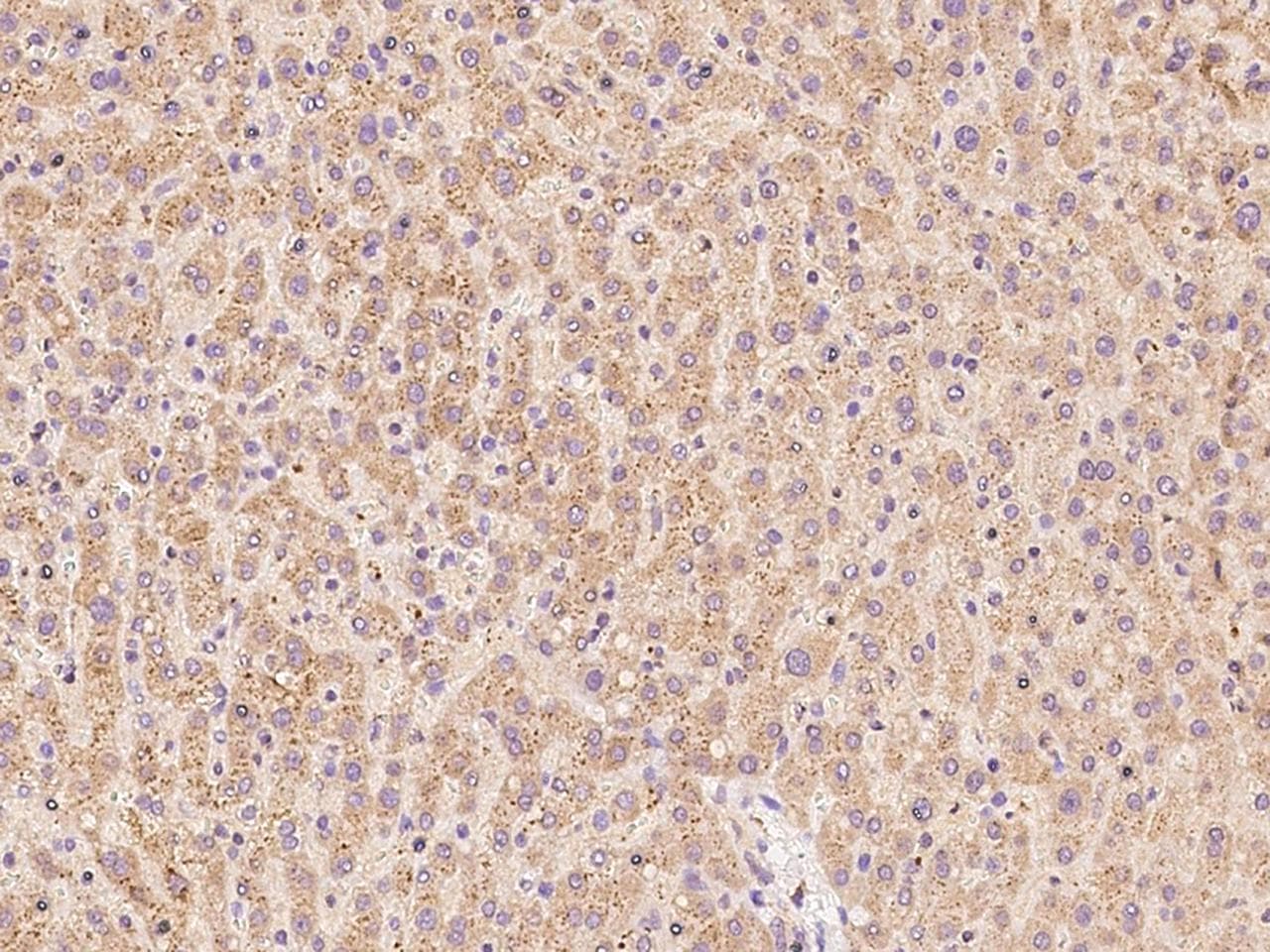 OCIAD1 Antibody