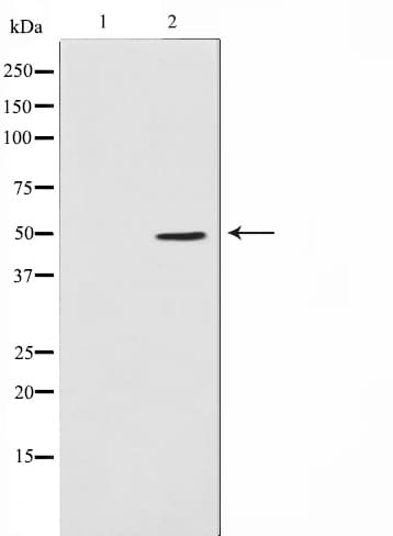 ADPGK Antibody
