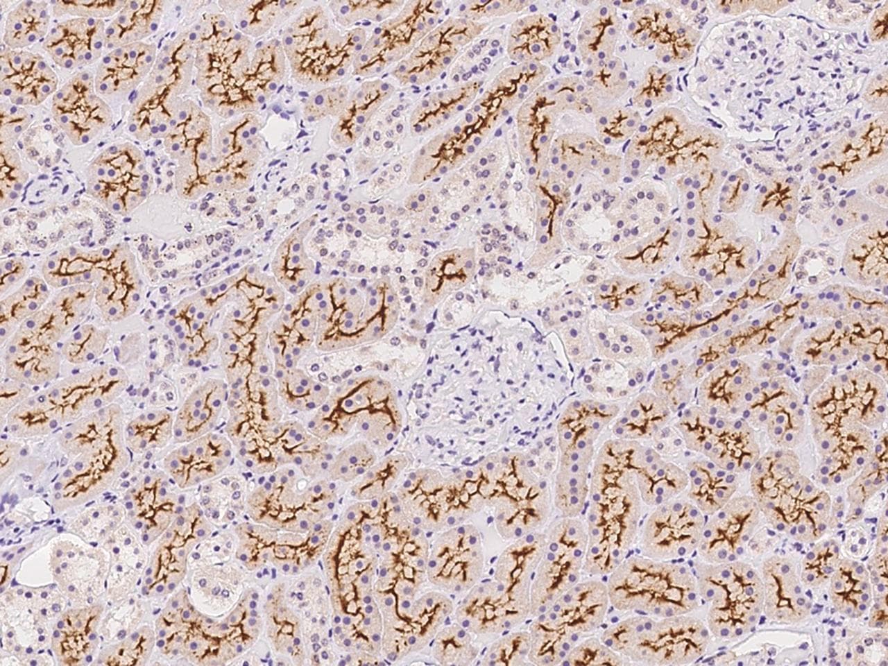 ACE / CD143 Antibody