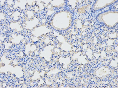 DPYD / DPD Antibody