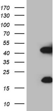Monoclonal Mouse anti-Human KLK3 / PSA Antibody (clone OTI3C8, aa25-261, WB)