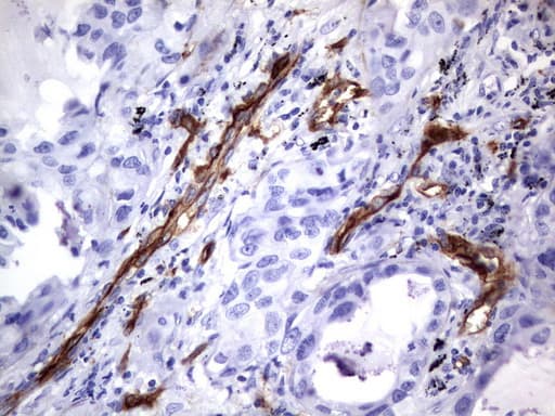 MCAM / CD146 Antibody (clone UMAB154)