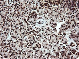 Monoclonal Mouse anti-Human SAE1 Antibody (clone 1G8, Carrier-free, IHC, IF, WB)