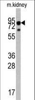 Polyclonal Rabbit anti-Human NTRK1 / TrkA Antibody (aa654-683, WB)