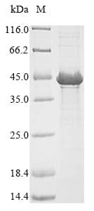 Neisseria meningitidis porA Protein (Recombinant 6His, N-terminus)