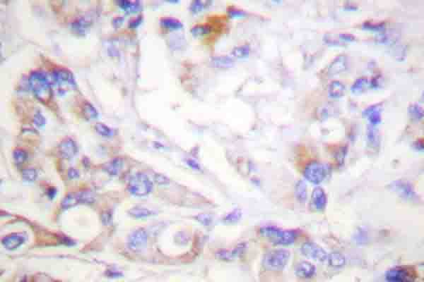 YWHAZ / 14-3-3 Zeta Antibody (phospho-Ser58)