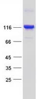 Human BICD1 Protein (Recombinant Myc-DDK (Flag))