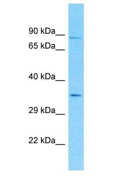 Polyclonal Rabbit anti-Human CML / BCR Antibody (aa343-392, WB)
