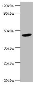 Polyclonal Rabbit anti-Human BCKDK Antibody (aa153-412, IHC, WB)