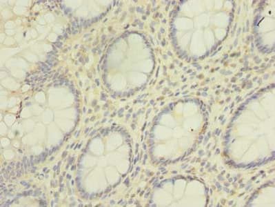 HNRNPL / hnRNP L Antibody