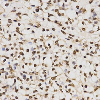 Histone H3 Antibody (Asym-Di-Methyl-Arg17)