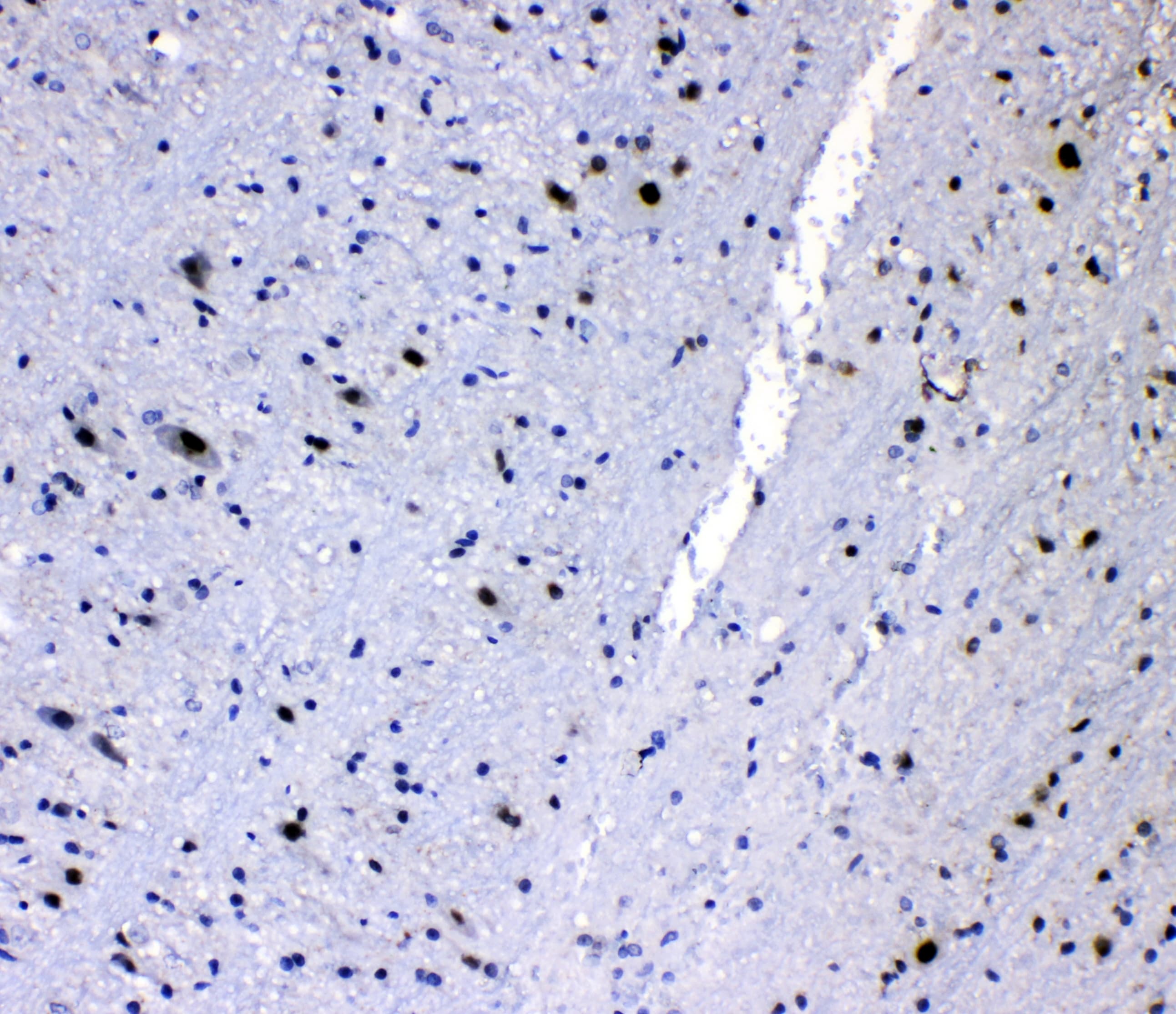 Polyclonal Rabbit anti-Human HNRNPL / hnRNP L Antibody (WB)